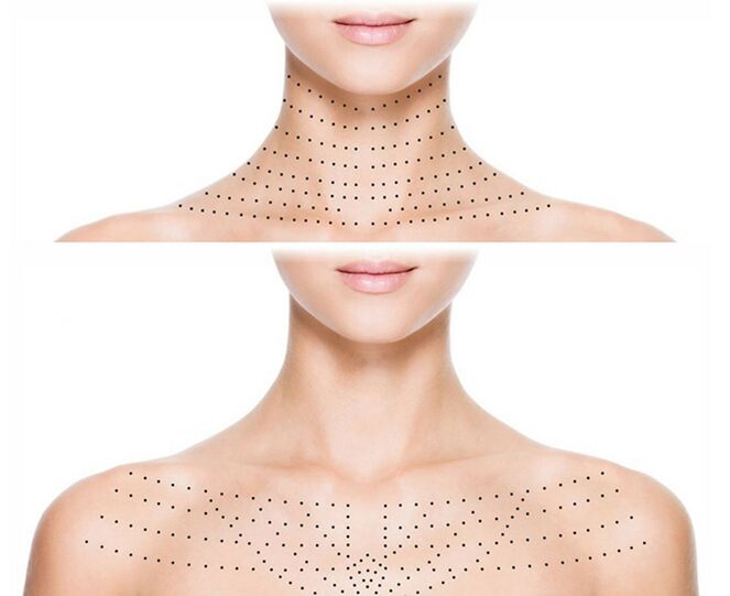 Marcar la piel del cuello y los hombros para restaurar la vitalidad biológica. 
