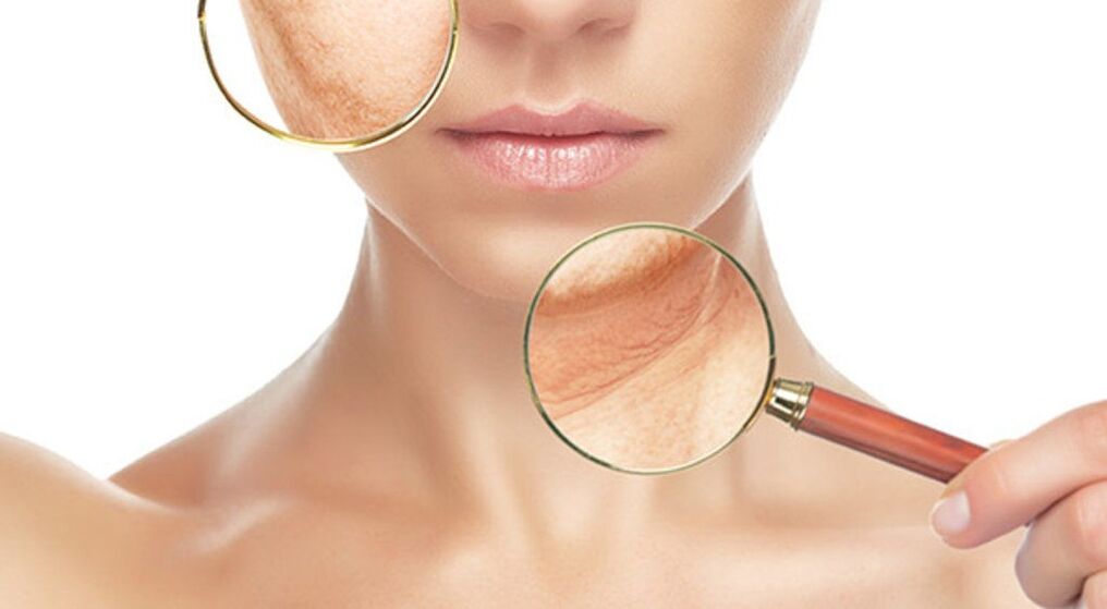 El tratamiento con láser puede eliminar eficazmente las arrugas